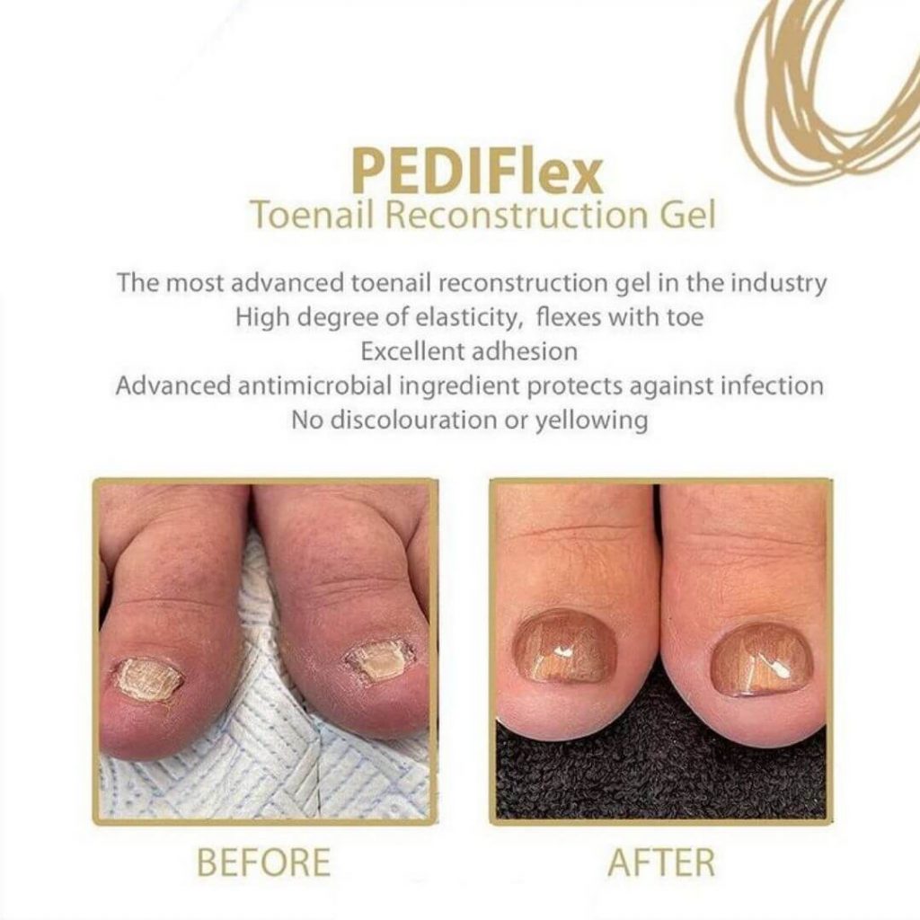 IKON.IQ Pediflex builder gel