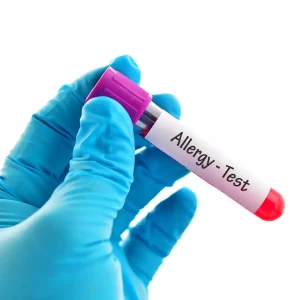 Alergije test