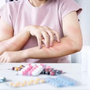 Kontaktni dermatitis kod nail tehničara