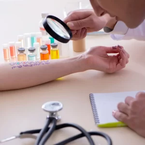 Alergije test